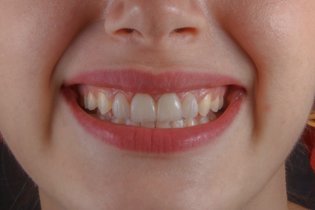 Sourire éclatant